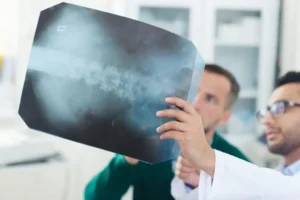 Doctor reviewing a spinal x-ray